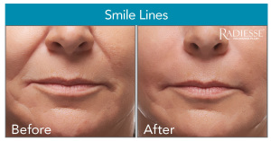 beforeandafter1